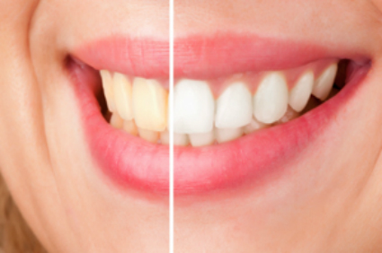 dental-services
